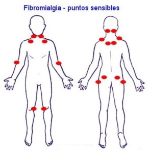 Simplemente- Fibromialgia-Mexico-DM (5)